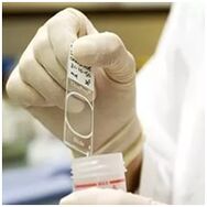Papilomavirus infekzioaren diagnostikoa