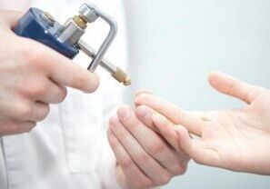 Papilomak kentzeko metodo modernoak